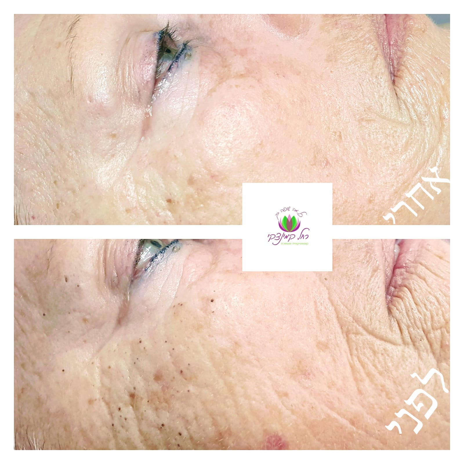 מומחית טיפולי אייג'ינג